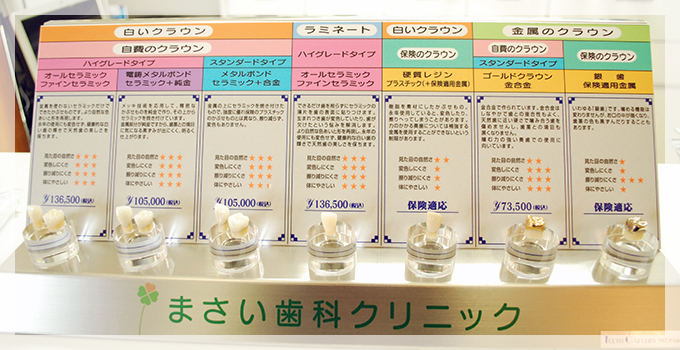オールセラミック